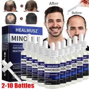 ✅ Minoxidil Topical Solution 5% Fast Hair Gowth -Hair Loss Treatment KLM Labs UK