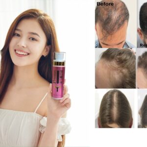 Japanese Hair Growth Serum Award-Winning Organic Leave-in Hair Loss Treatment